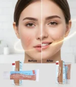 Trophic Scar Repair - Image 2